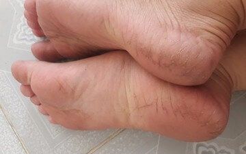 Ủ chân trong khoảng 90 phút sẽ cho hiệu quả tốt nhất