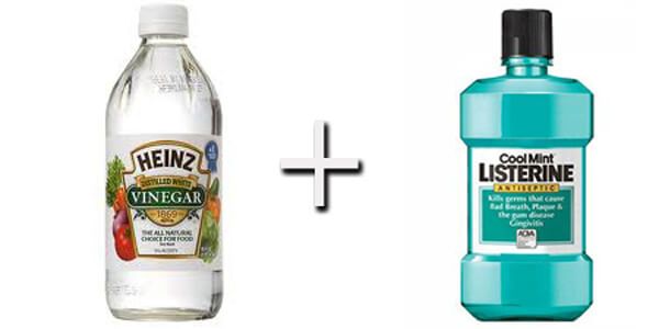 Nước súc miệng Listerine và giấm sẽ giúp chữa nứt nẻ gót chân